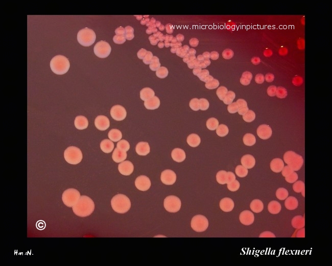 shigella on Endo agar